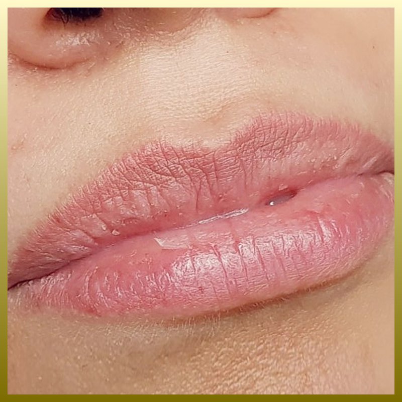 labbra-rossetto-before