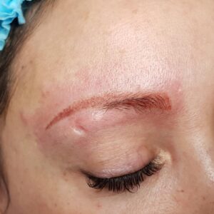 viktoria-logoida-pigment-killer-remouve-41