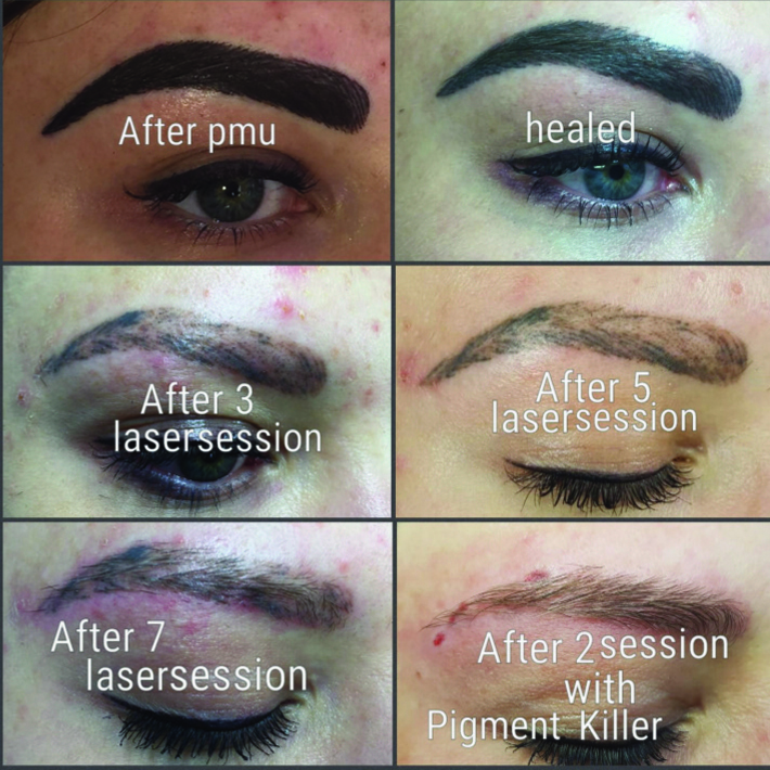 64fd700d-9fc7-4a2d-9861-1b064b8e9311